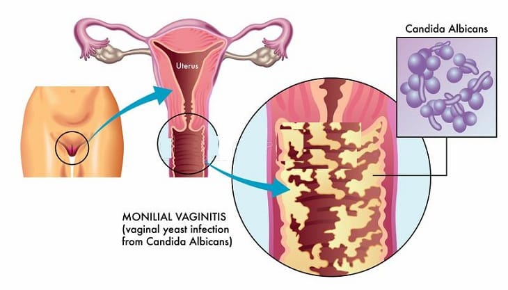 Nguồn hình ảnh: Medlatec
