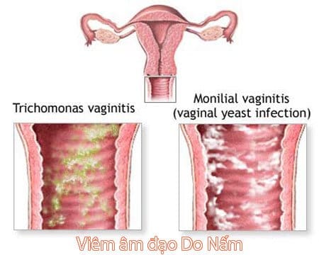 Nguồn hình ảnh: Lavima